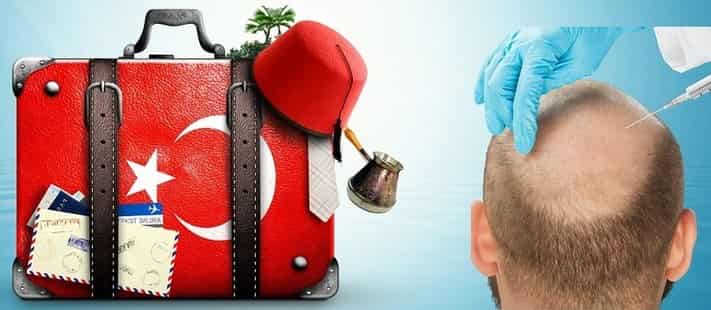 Türkiye'de Saç Ekiminin Maliyeti 2026