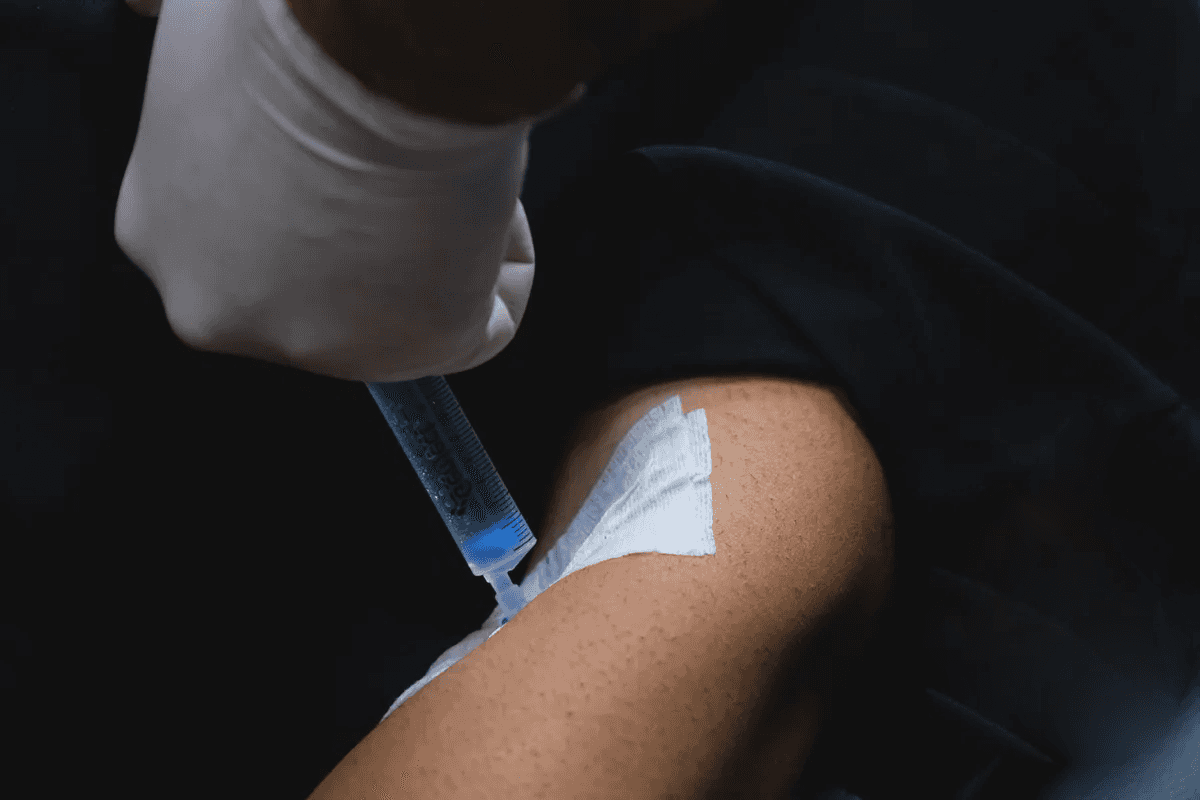 Hasta Konforunu Artırmak: Saç Ekimi İşlemlerinde Sedasyonun Rolü