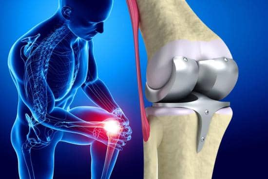 Yapay Diz Eklemi Sonrası Diz Rehabilitasyonu
