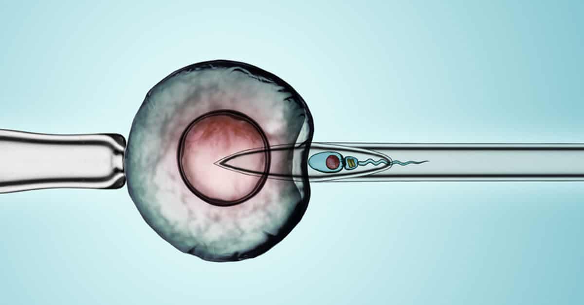 Tüp Bebek Başarısız Olduktan Sonra Mikroenjeksiyon: Daha Yüksek Başarı Oranı Sağlar mı?