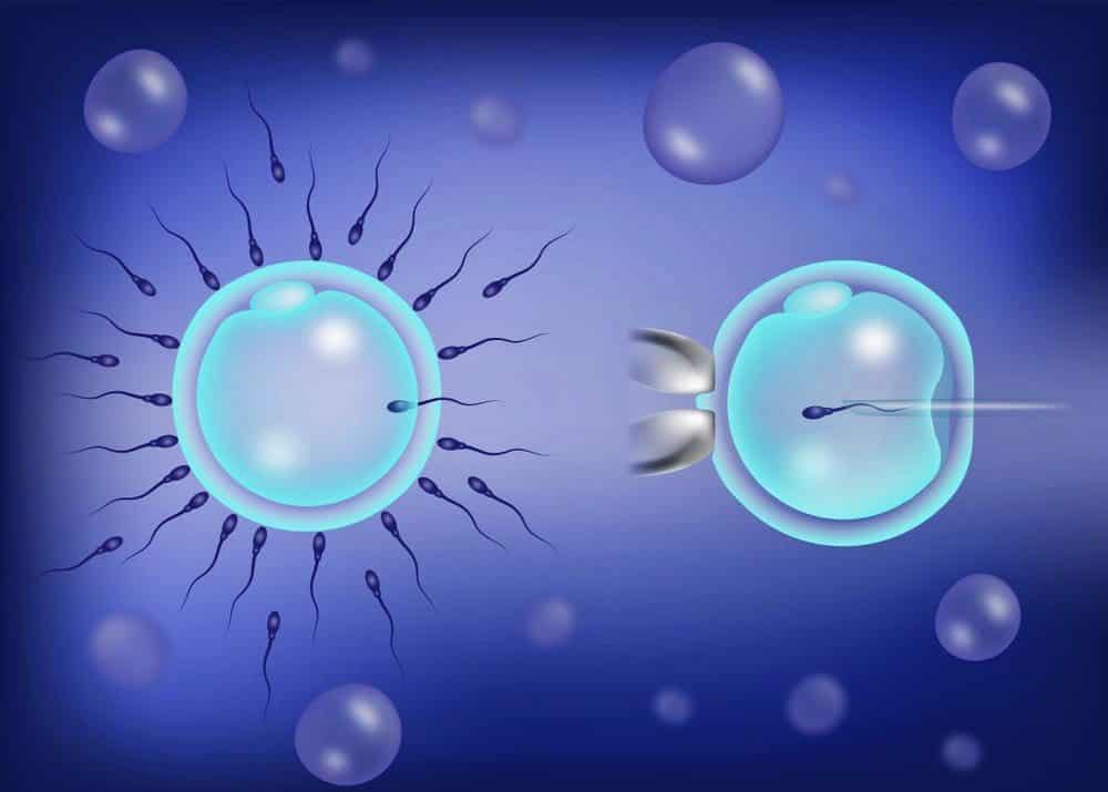 Tüp Bebek ve Mikroenjeksiyon (ICSI): Aralarındaki Temel Farklar