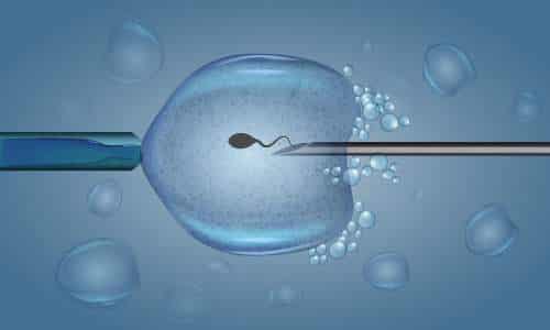 Mikroenjeksiyon Öncesi Analizler: Neden İşlem Başarısı İçin Gerekli?