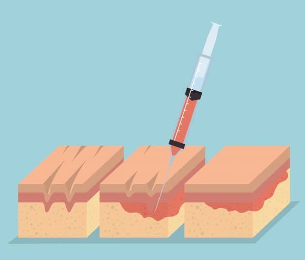 Doğum Sonrası Liposuction: Faydaları ve Riskleri