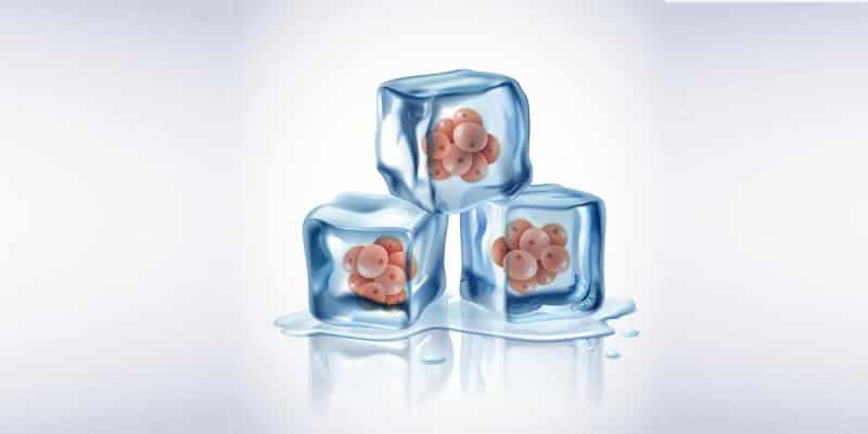 Yumurtaların Dondurulması ile Tüp Bebek Tedavisi: Aşamaları