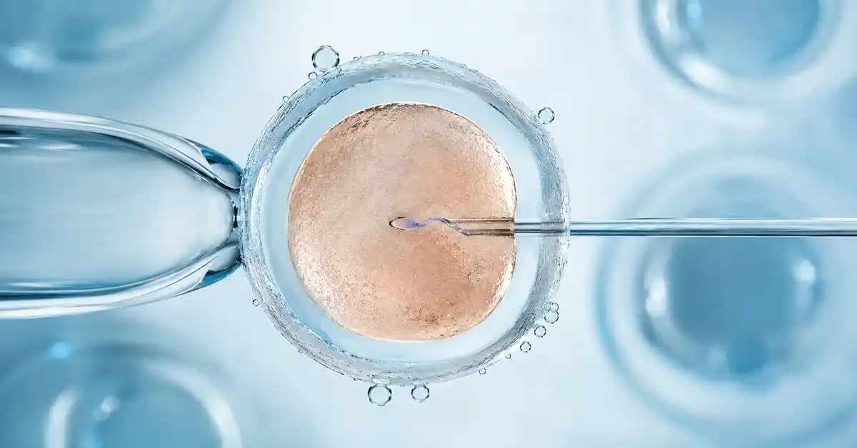 ICSI After Failed IVF: Does It Offer Higher Chances of Success