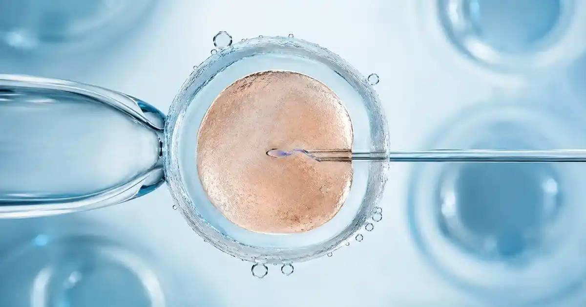ICSI After Failed IVF: Does It Offer Higher Chances of Success