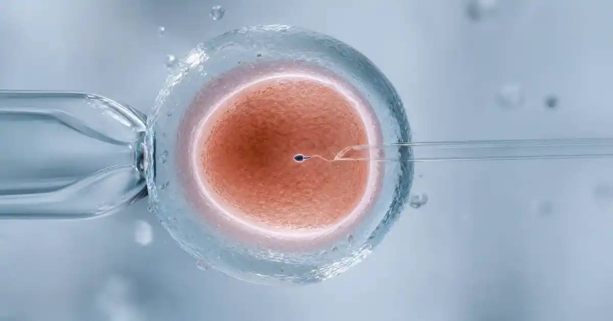 ICSI Cost & Success: Turkey vs USA
