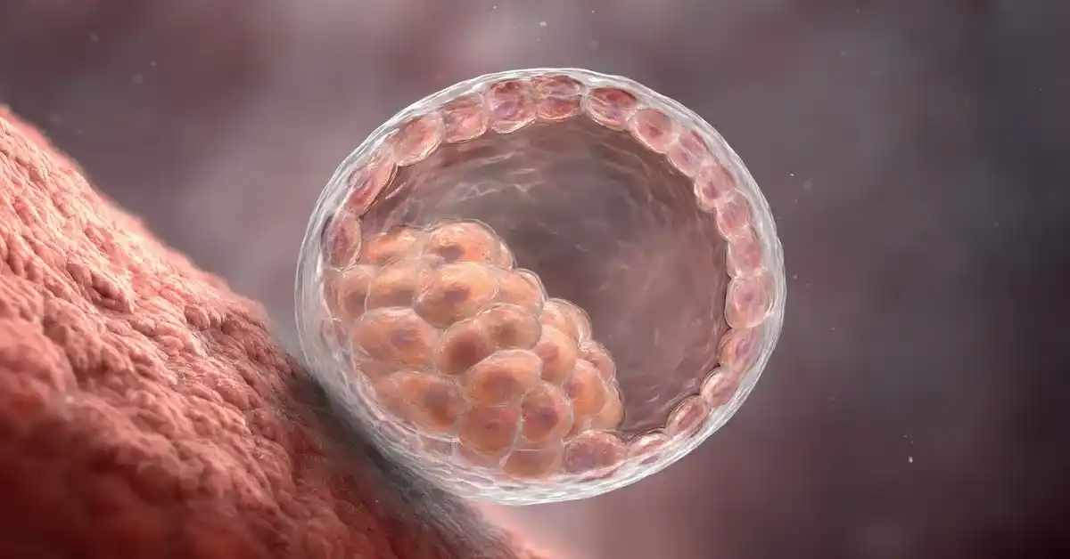 IVF Cost and Success: Turkey vs USA