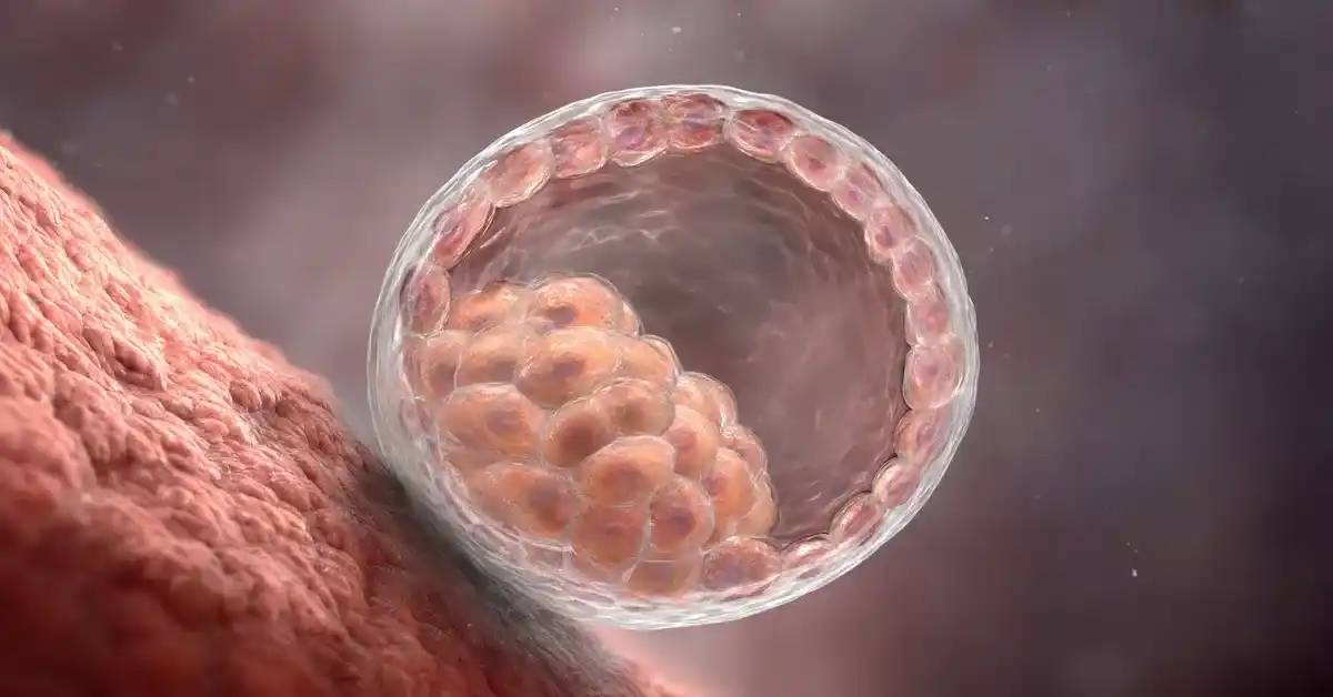 IVF Cost and Success: Turkey vs USA
