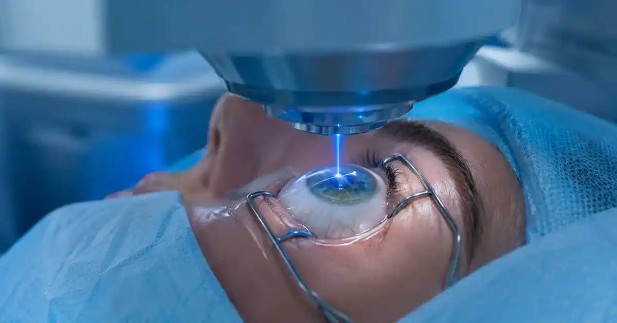 LASIK vs Femto LASIK: How to Choose the Best Vision Correction